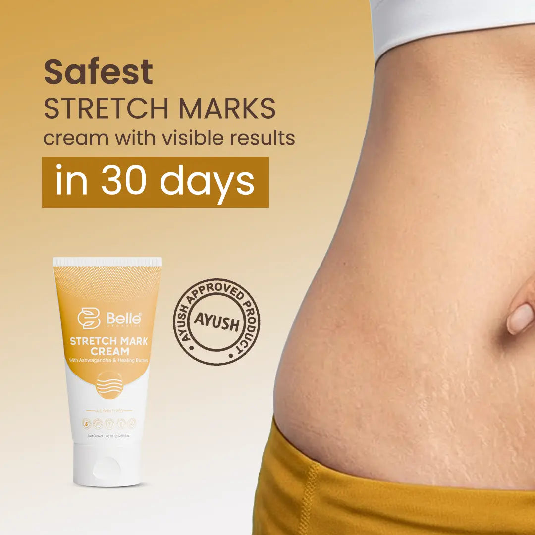 Stretch Mark Cream (60 ml) – Reduce Stretch Marks Naturally