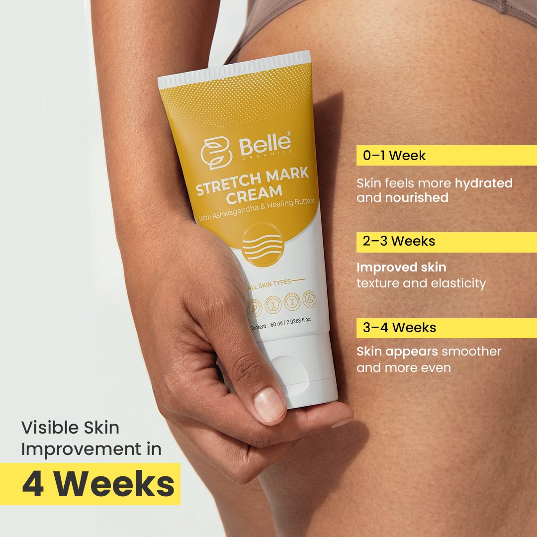 Stretch Mark Cream (60 ml) – Reduce Stretch Marks Naturally