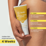 Stretch Mark Cream (60 ml) – Reduce Stretch Marks Naturally
